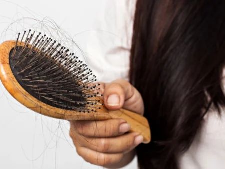 Comprehensive Guide to Managing Hair Loss